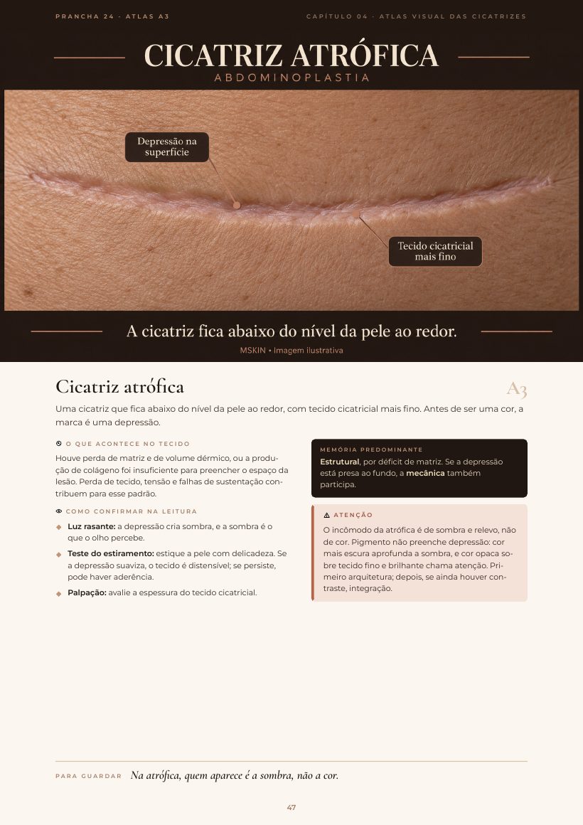 Página do e-book: Cicatriz atrófica