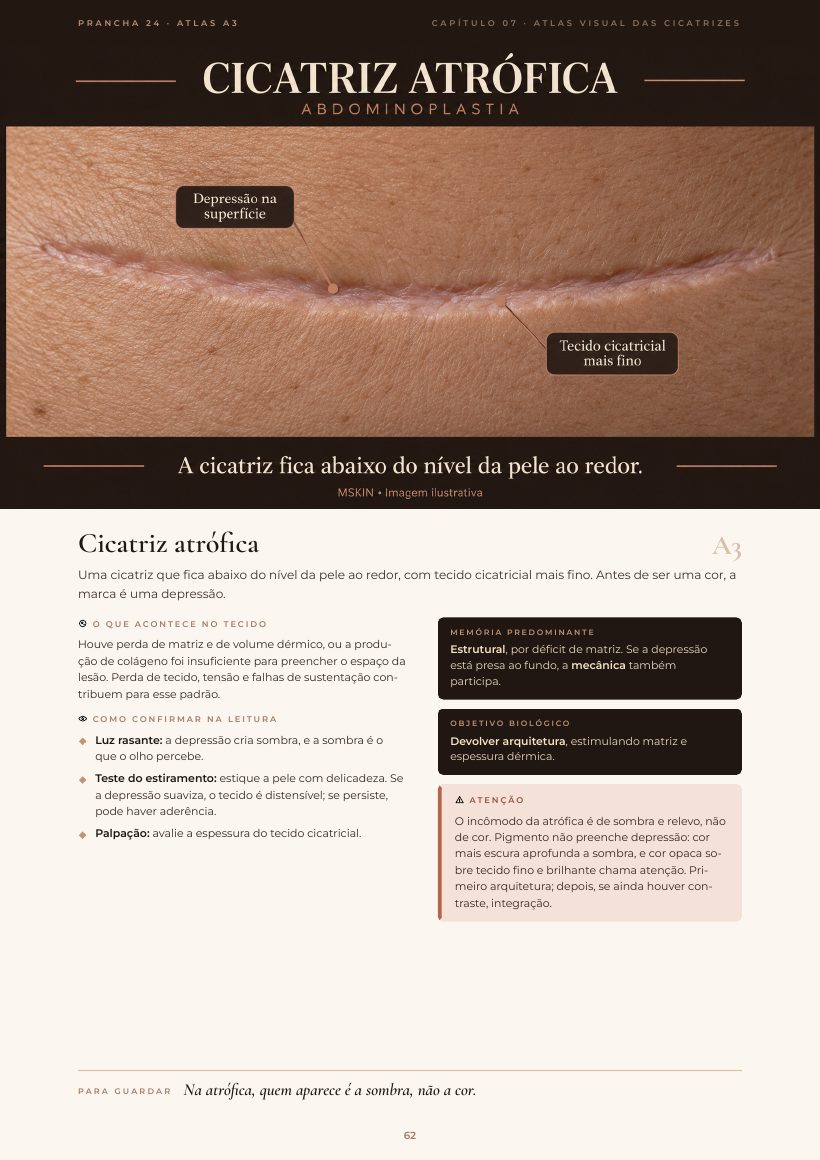 Página do e-book: Cicatriz atrófica